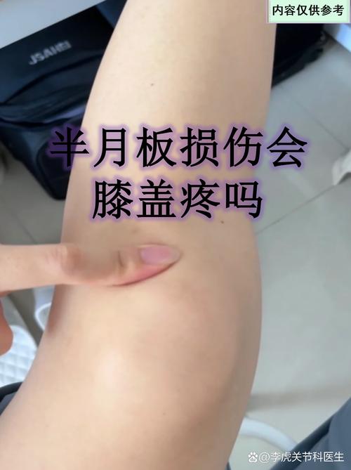 迪马：迪巴拉膝盖关节囊炎症&缺席两周，已排除结构性损伤